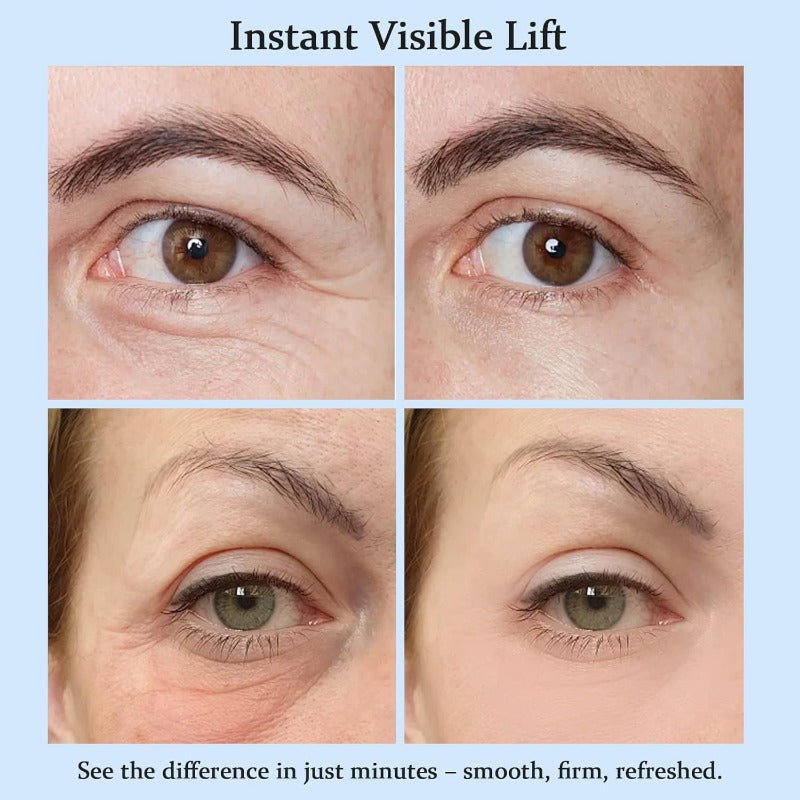 YoPoll Instant Eye Lift Cream Lifts & Refreshes Tired Eyes