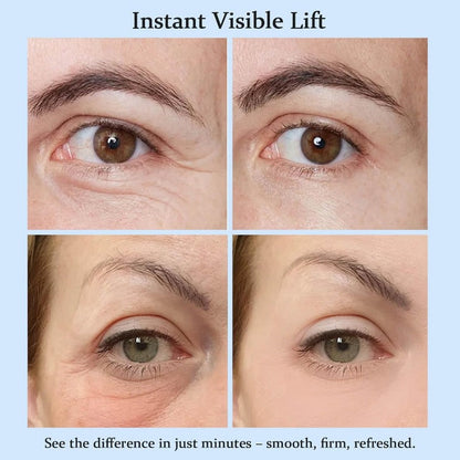 YoPoll Instant Eye Lift Cream Lifts & Refreshes Tired Eyes